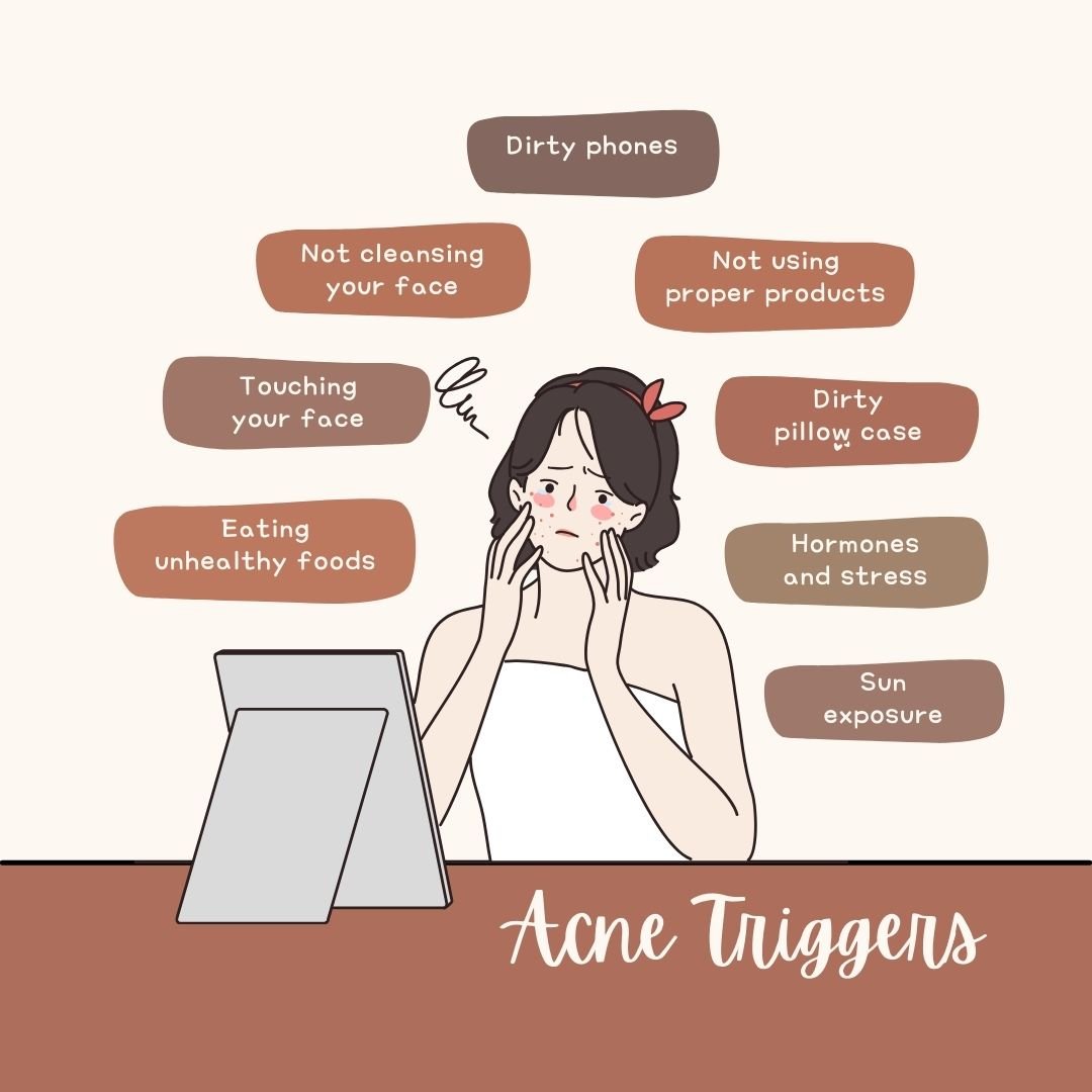 PCOS Acne Blog Image - Exploring Acne Triggers with insights from Dr. Shabnam Sharjil at PCOS Ferticure Clinic for effective PCOS-PCOD management.